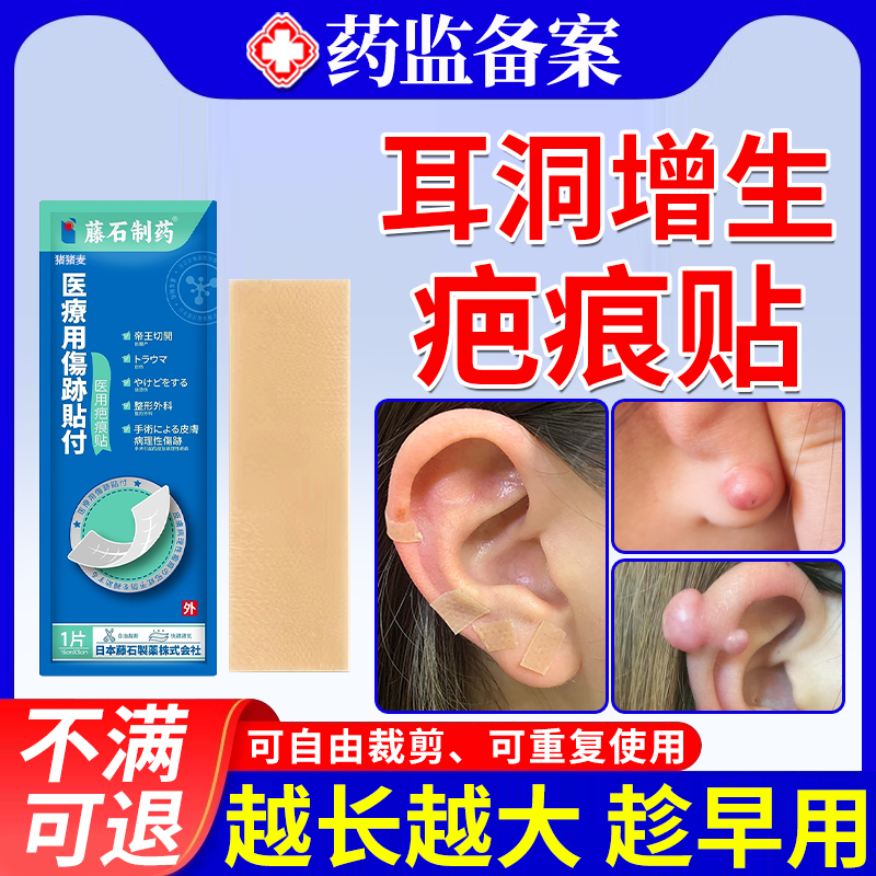【医用级】耳洞增生疙瘩去除贴