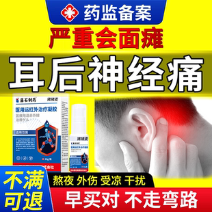 耳后三叉神经痛止专用耳廊耳背耳朵耳根疼痛抽筋牙疼膏药贴OZ