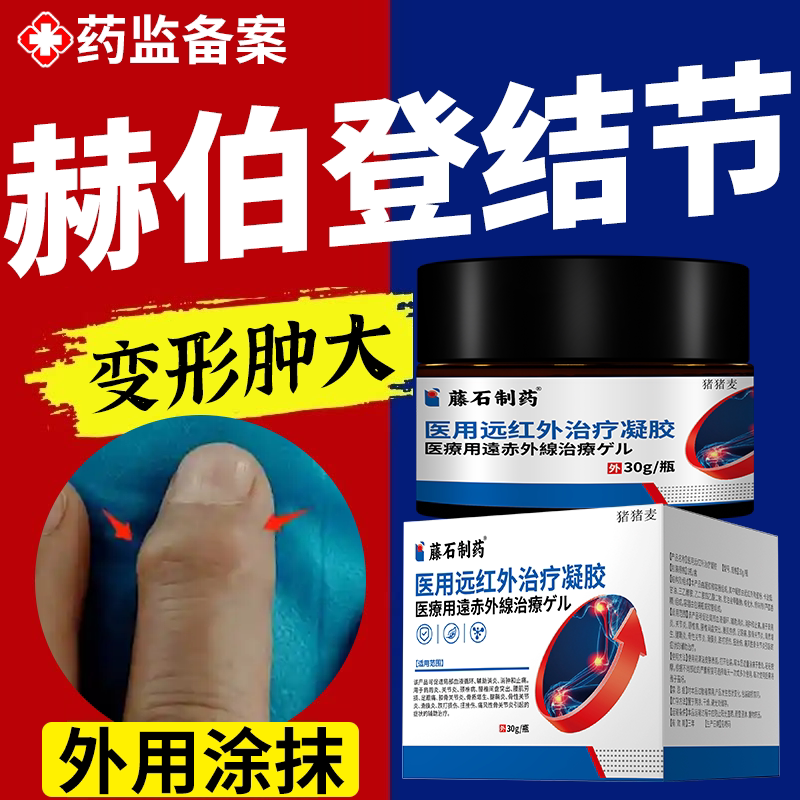 远红外治疗】赫伯登结节手指关节图片