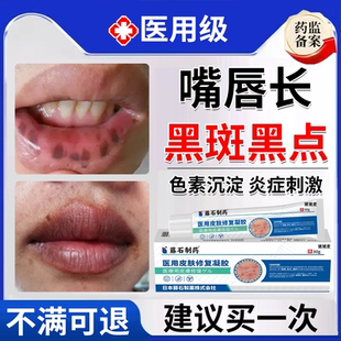 唇炎去嘴唇有黑斑周围黑色素沉淀去除黑点发黑唇部护理淡化黑痣EM