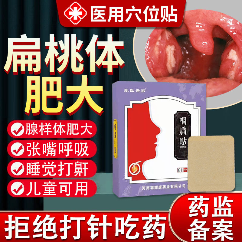扁桃体肥大肿大贴腺样体中药贴咽喉肿痛喉咙发炎药有痰异物感JW