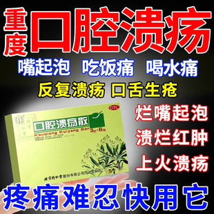 北京治疗口腔溃疡散绿袍散万通专用药消炎药舌头溃疡