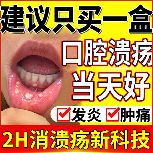进口口腔溃疡凝胶儿童特效溃疡灵专用贴药膏喷剂一点灵散膜贴喷雾