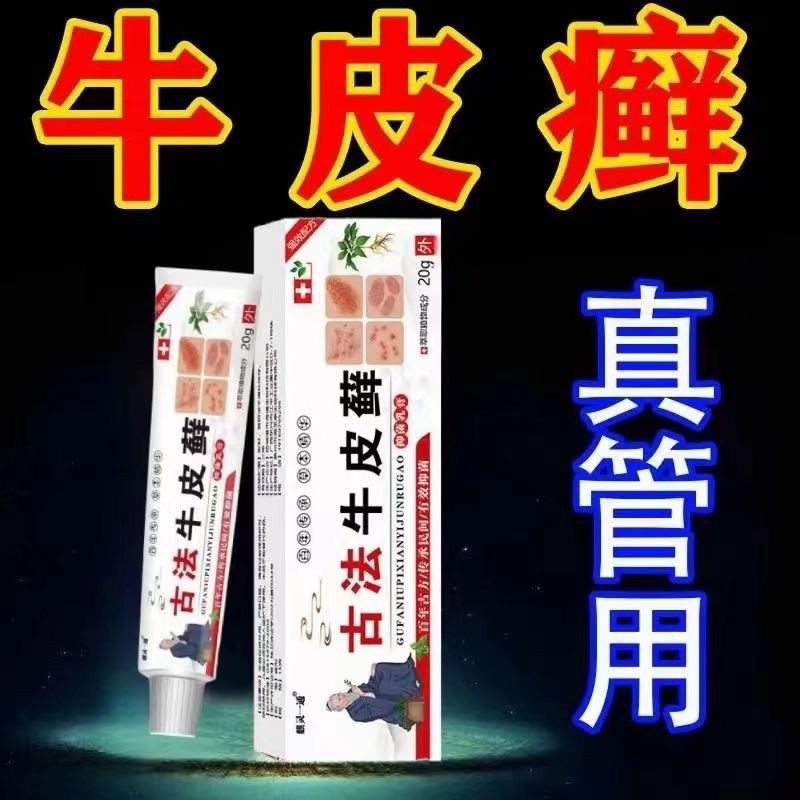 牛皮癣药膏特效皮肤瘙痒止痒膏手足癣神经性皮炎湿疹银屑病老偏方