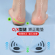 小腿肌肉外翻矫正o型腿鞋 垫XO型罗圈腿x型腿腿型神器直腿磁石鞋 垫