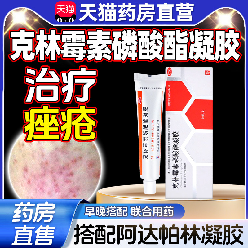 【天辰】克林霉素磷酸酯凝胶1%*10g*1支/盒祛痘去痘去痘印闭口粉刺