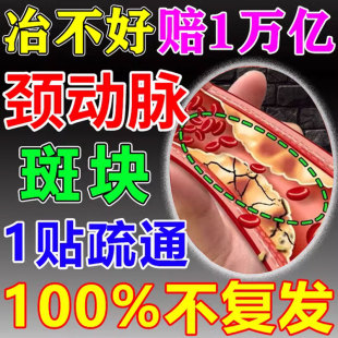 颈动脉斑块疏通软化血管堵塞狭窄硬化粥样化缓解脑梗供血不足头晕