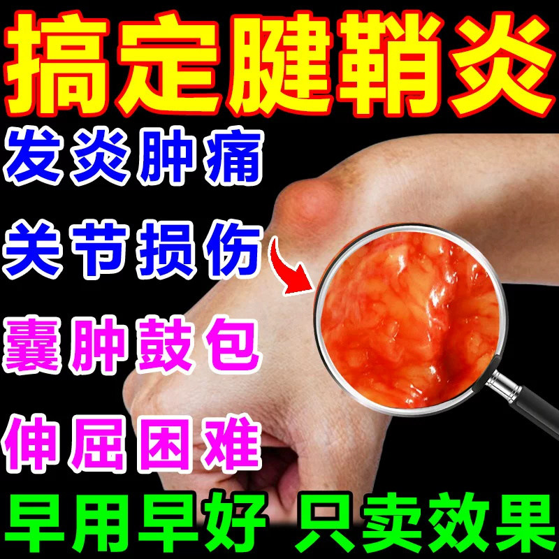 青大将丸治疗风湿性关节炎类风湿关节炎专用药祛风除湿疏通经络
