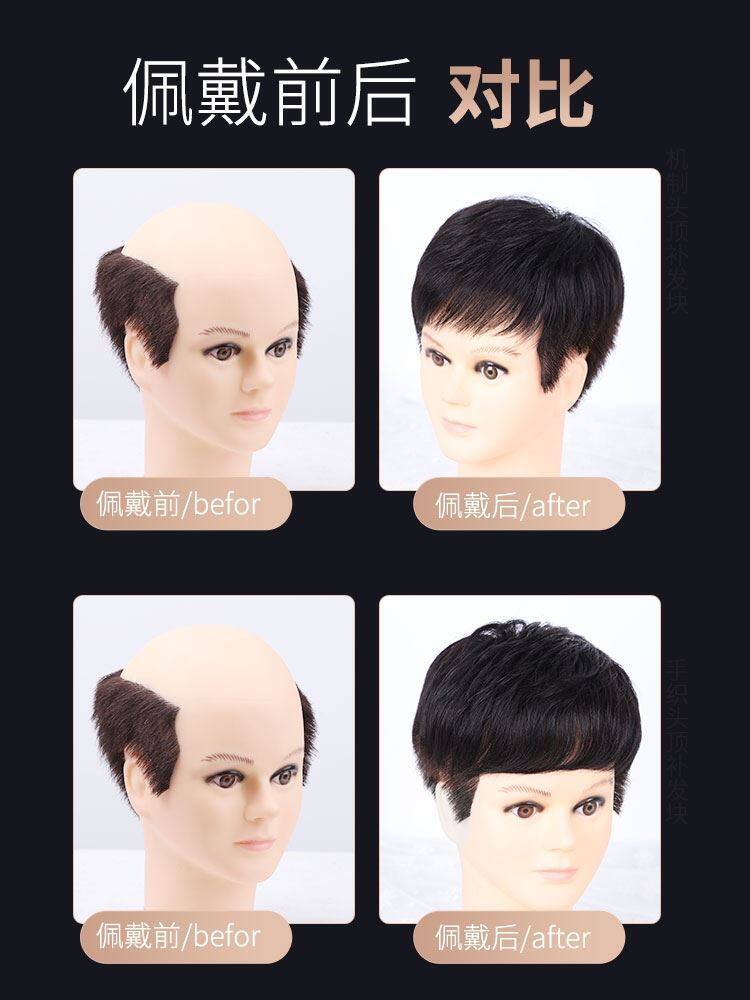 男士真发假发头顶补发片短发 ページ 3