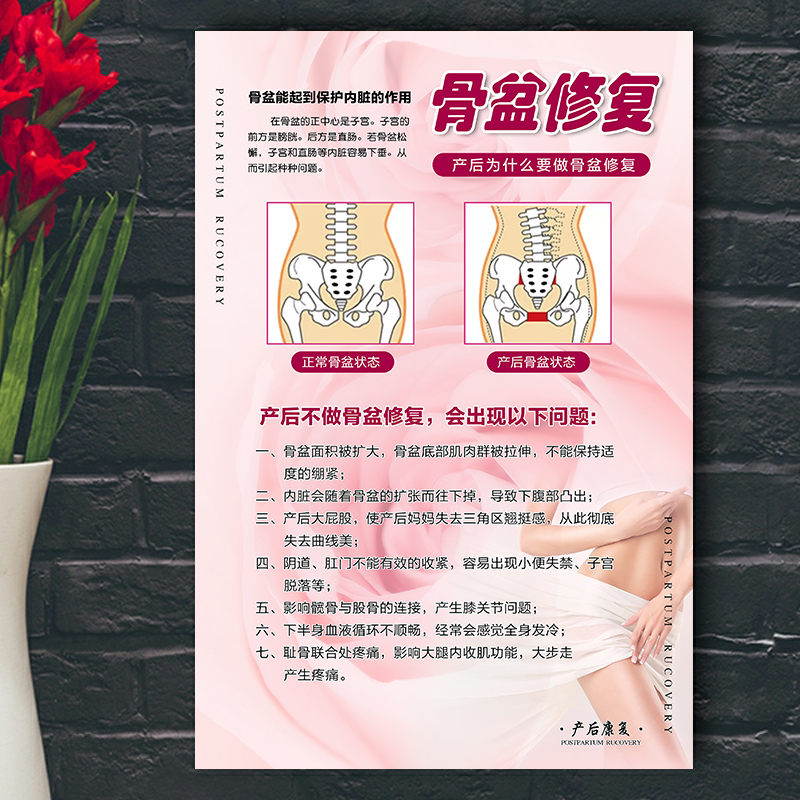 产后骨盆修复广告宣传海报定制贴墙图满月发汗无痛催y乳图片挂画