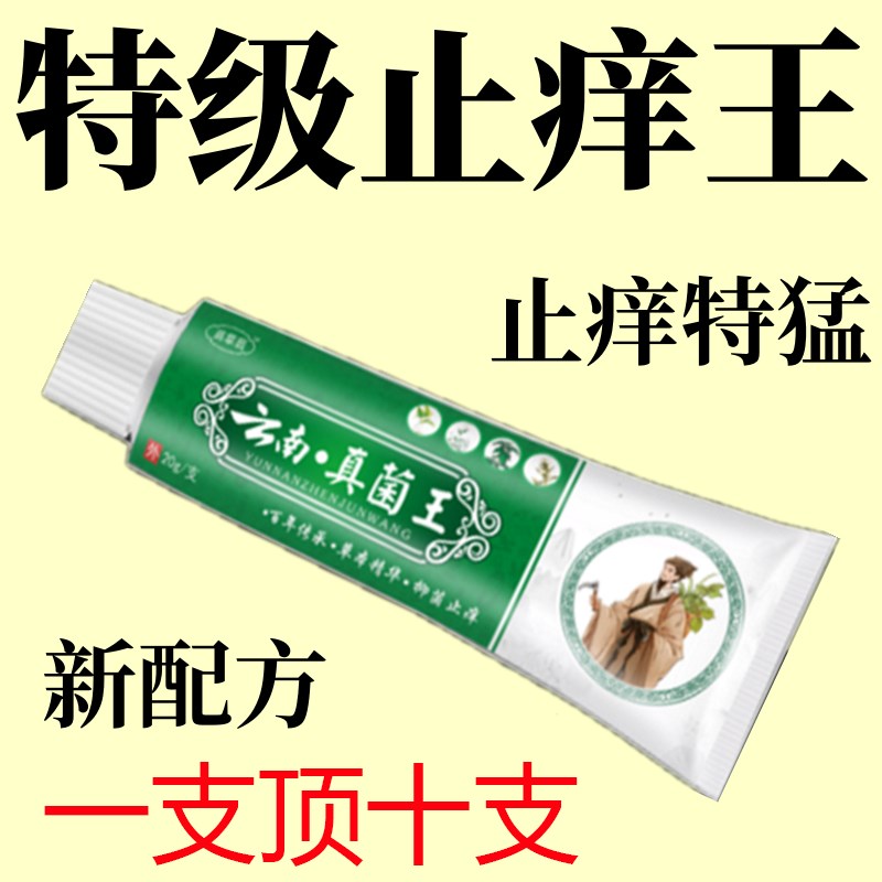 云南真菌王】特性止痒王快速止痒皮肤瘙痒外用干痒止痒膏全身瘙痒