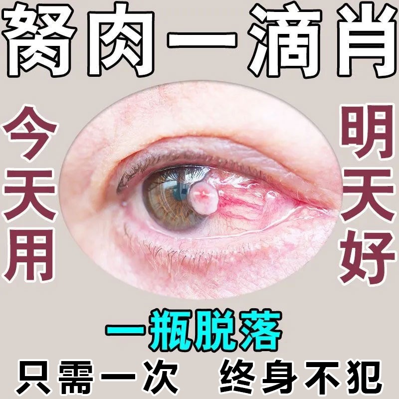 去除眼睛胬肉滴眼液眼球黄斑干痒红血丝模糊看不清眼白发黄眼水