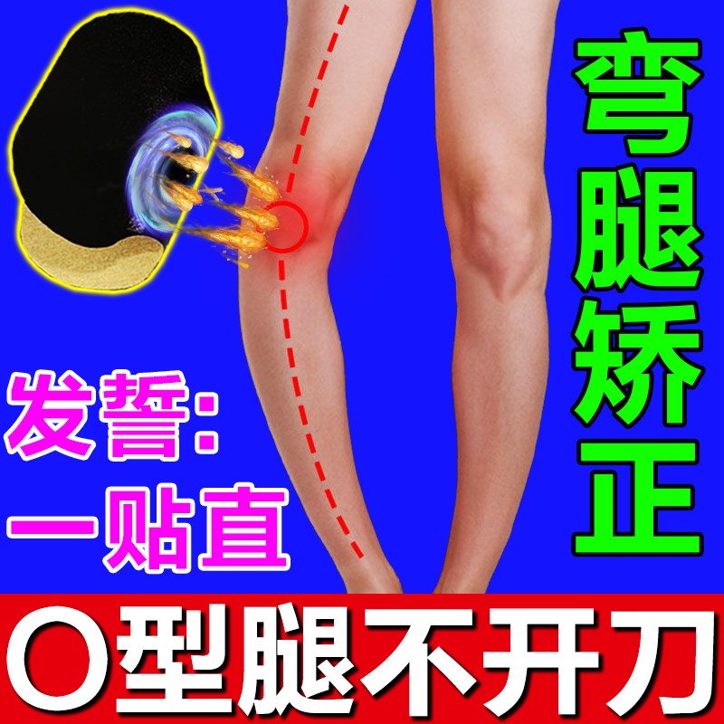 O型腿矫正神器小腿外翻非鞋垫XO型罗圈腿直腿神器纠正腿型美腿贴