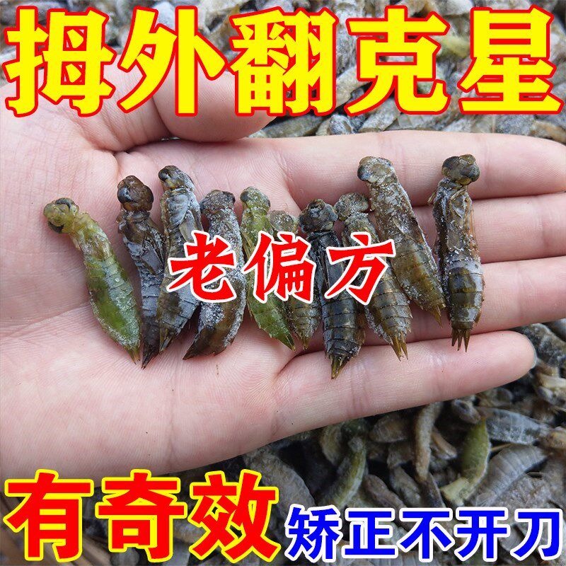 大脚趾拇指外翻膏药贴大脚趾拇囊炎大脚骨专用矫正贴关节畸形疼痛 - 实物图