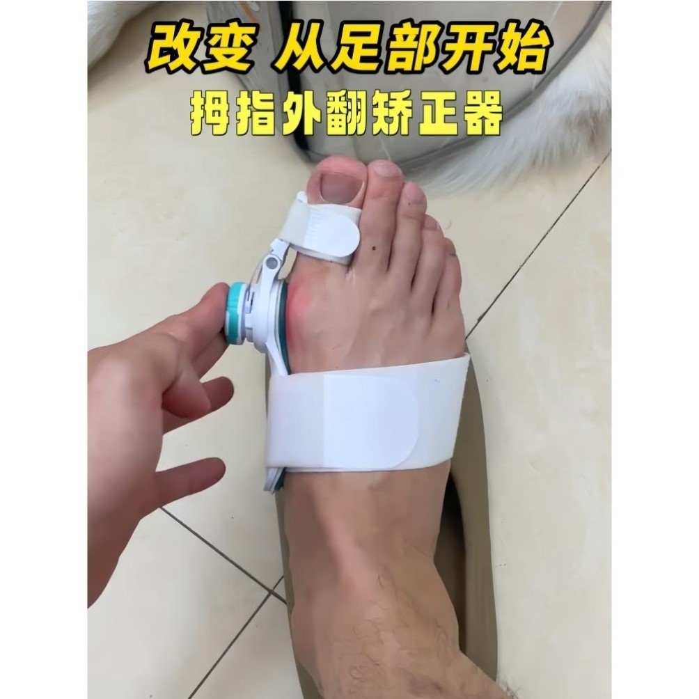拇外翻矫正器女士可调节大母脚趾分趾器脚骨突出矫正器脚趾头矫形