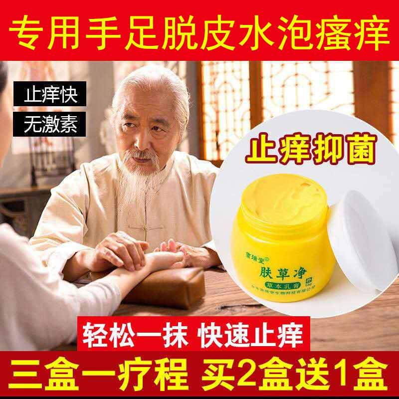 治疗鹅掌风湿疹手部手气膏真菌感染手上手足藓蜕脱皮水泡止痒药膏