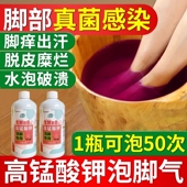 高锰酸钾泡脚去真菌除脚气止痒脱皮杀菌洗脚液臭脚出汗药水药包