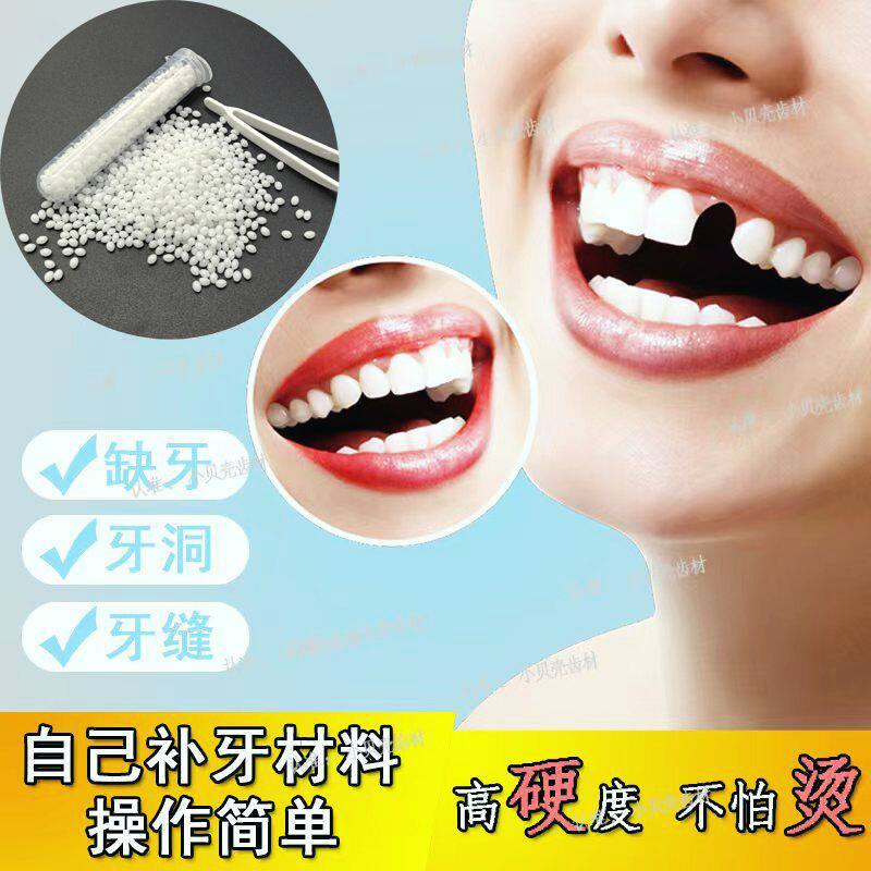 补牙神器自己在家补牙新款补牙齿材料自己动手补牙齿补缺牙填牙洞