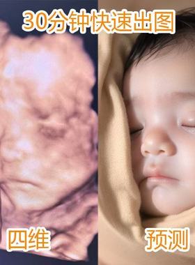 宝宝四维AI照片预测胎儿长相三维4维五维彩超婴儿胎儿孕妇b超还原