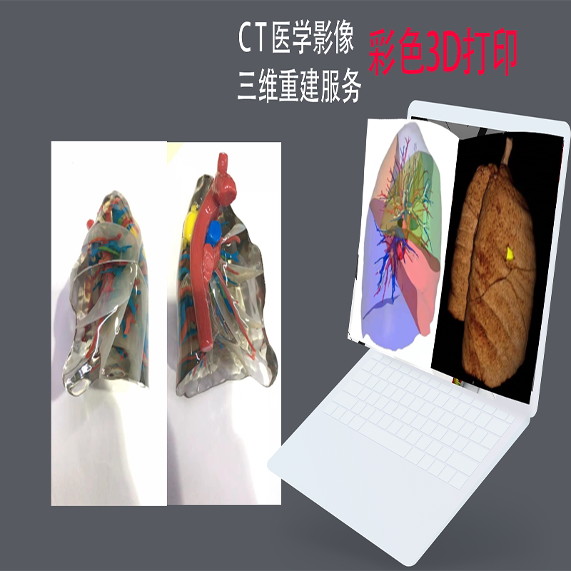彩色3D打印肝脏医疗展示模型定制图片