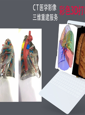 彩色3D打印医学CT三维重建DICOM文件医疗影像转换可视化技术服务