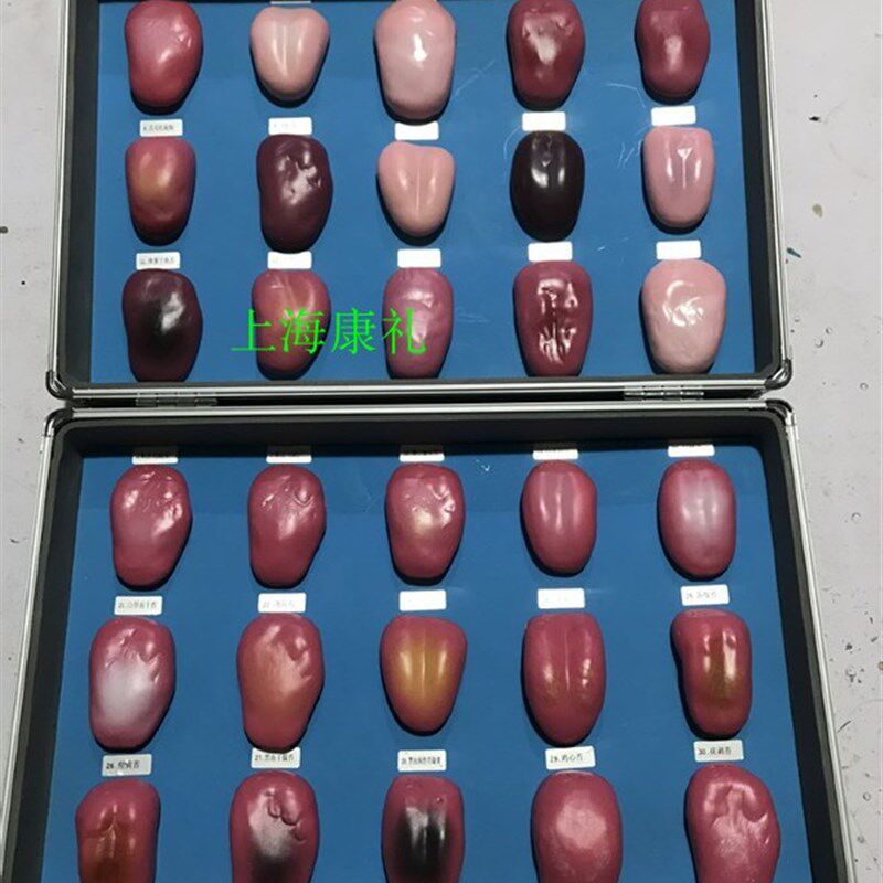 厂家直销 舌g苔模型 常见病对比较 舌像模型30件/套 舌头诊断模