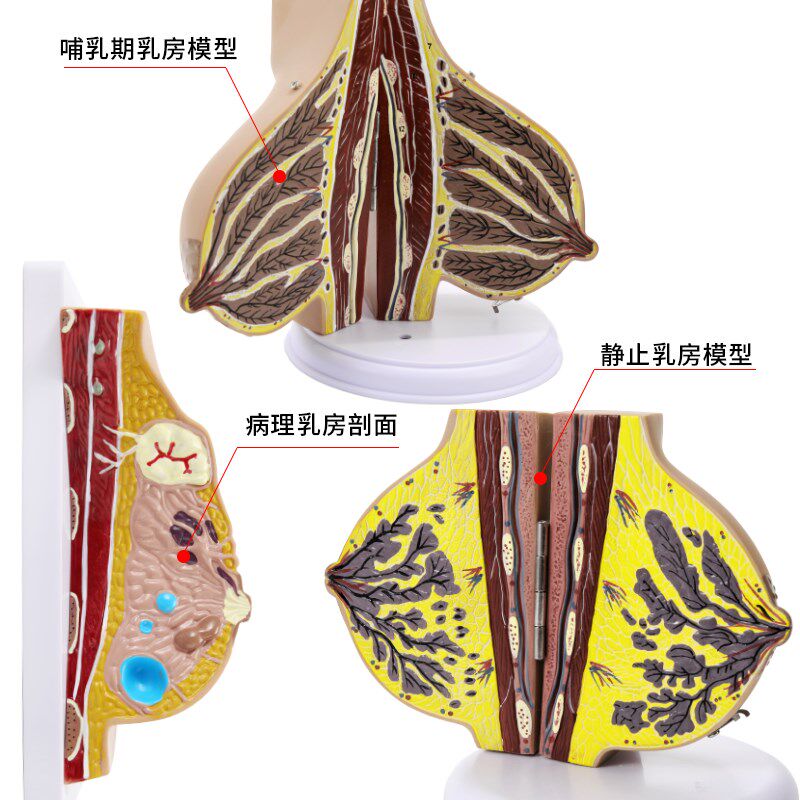 医学女性乳房教学模型仿真人体器官乳腺结L构组织病变解剖模具教