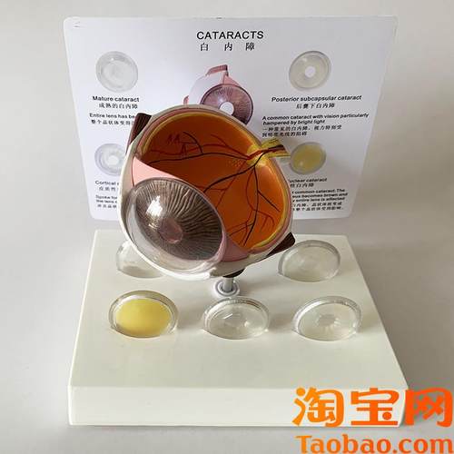白内障眼睛模型晶片虹膜s器官解剖光学教仪医用医学教学教具包邮