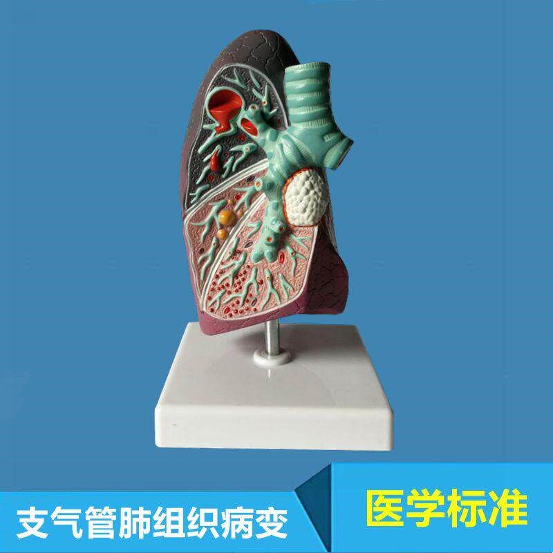 人体肺模型支气管j肺泡呼吸道病理医患沟通医药促销礼品肺组织病