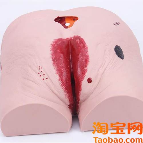 褥疮压疮护理模型老年人褥疮压G疮护理模型医学用教学模型