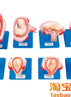 妊娠胚胎发育过程模型42005胎儿形成发L育过程模型双胎子宫模型