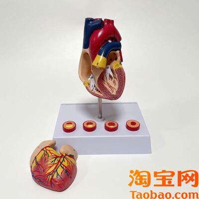 心血管阻塞模型粥样血管内膜受损脂肪斑H块沉积管腔狭窄栓子堵塞