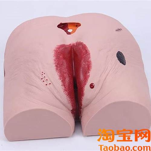 老年人褥疮(压疮)护理模型褥疮护理H模型压疮护理模型褥疮模型