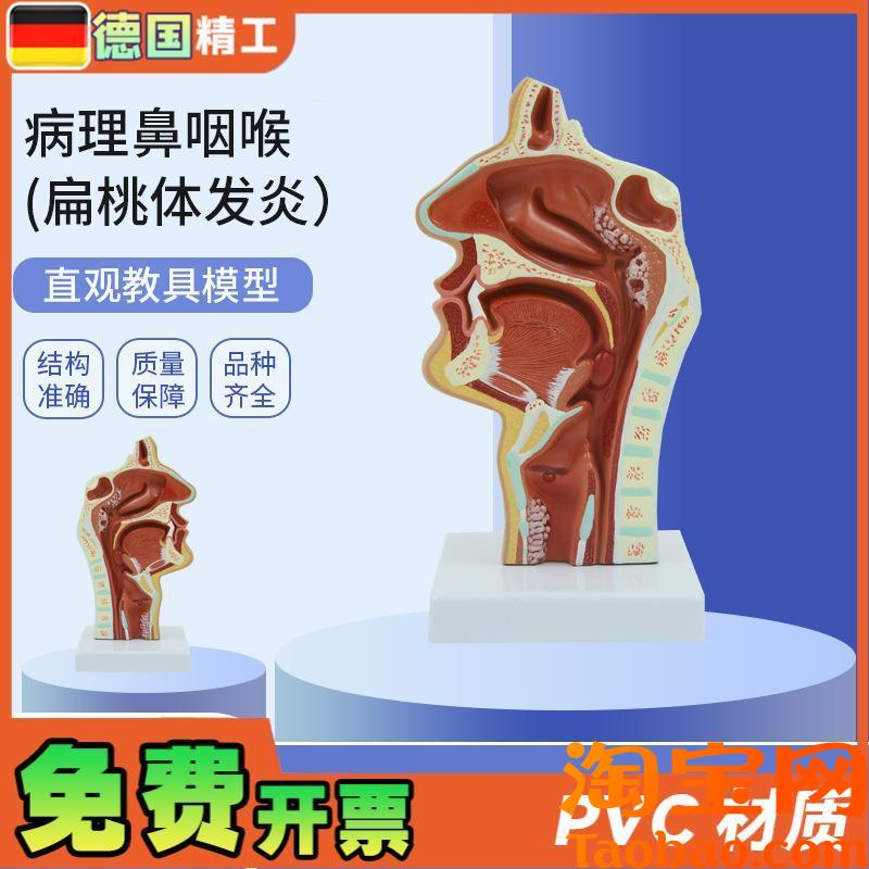 原装适用德国】PNT-0736人体鼻腔咽喉解剖教学模型病理鼻咽喉(扁