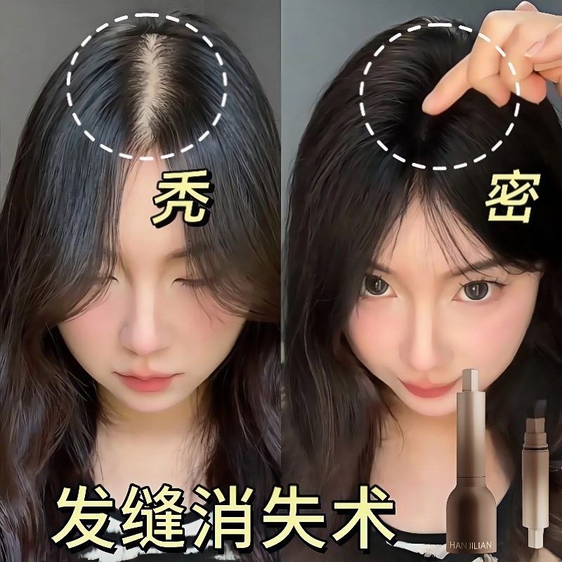 告别大额头~毛流感发际线液补发