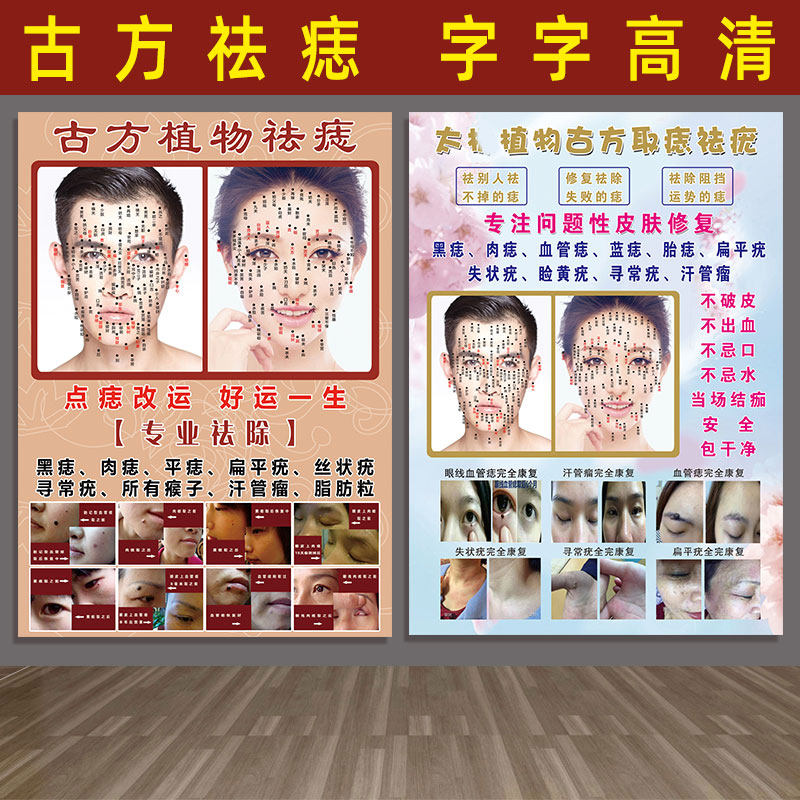 男女面痣图海报面部点痣袪疣广告取痣面相广告画挂t图古方植物祛