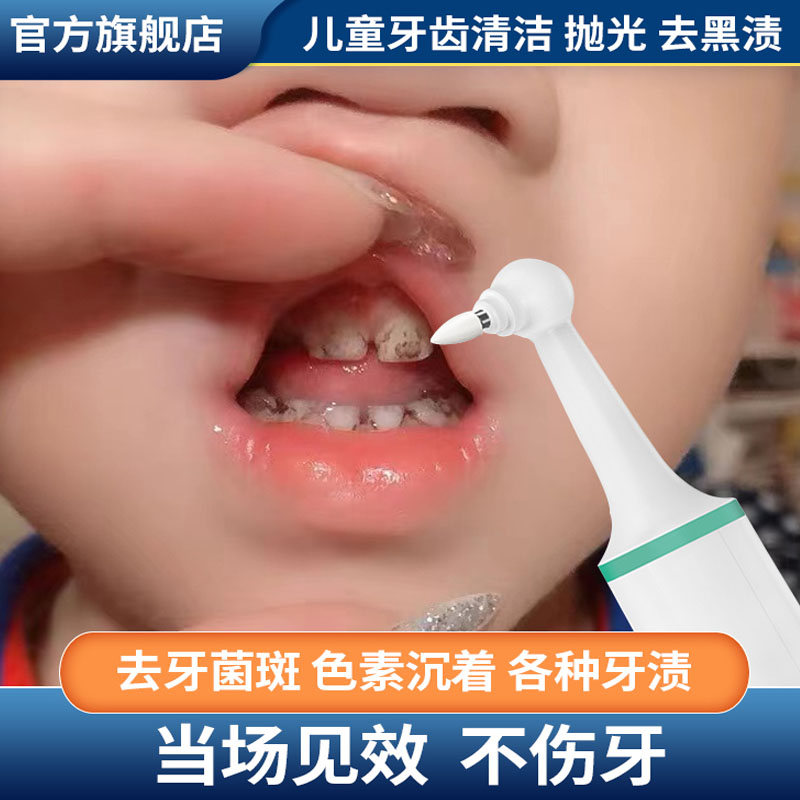 儿童牙齿清洁抛光器去色素沉淀