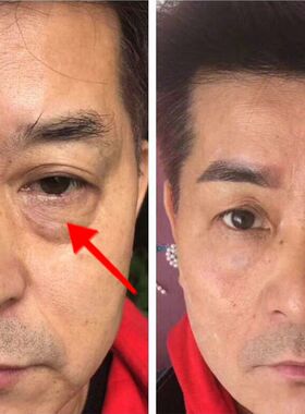 快速祛消去除黑眼袋大眼袋霜浮肿眼袋神器男士专用的草本眼霜