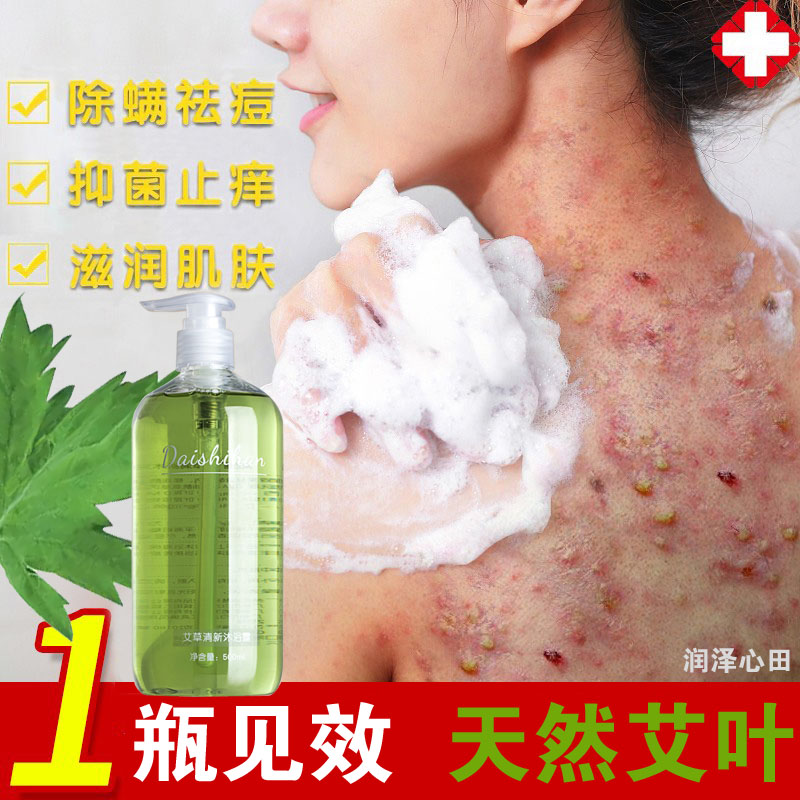 鸡皮肤长痘痘用沐浴露好香皂的简单介绍 鸡皮肤长痘痘用沐浴露好香皂的简单介绍