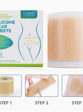 ELAIMEI新款疤痕贴疤痕卷大尺寸3米长去除淡化修护疤痕剖腹产疤贴