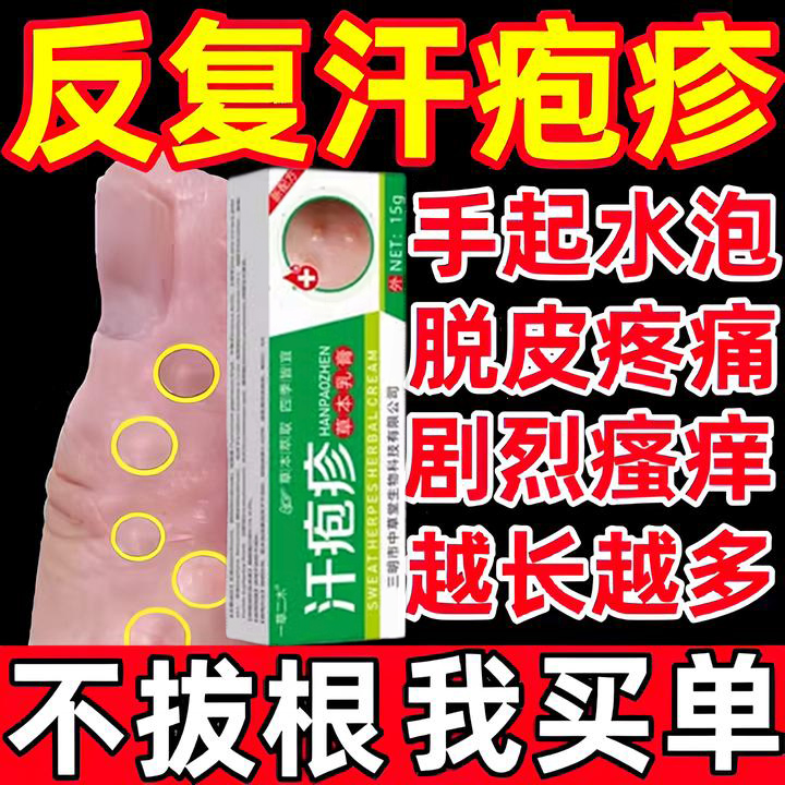 汗泡疱疹药膏手上起小水泡手痒干裂脱皮止痒汉状真菌感染专用软膏-封面