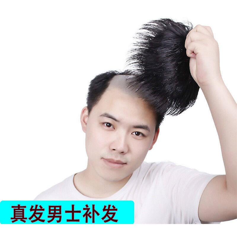 唐妮男士补发片假发套头顶补发前额秃顶补发垫接发翻盖假发真发男怎么看?