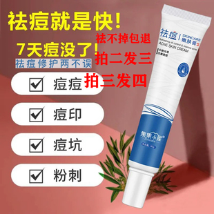 佳琪推荐 祛痘膏快速祛青春痘粉刺闭口白头淡化痘印学生祛黑头修复
