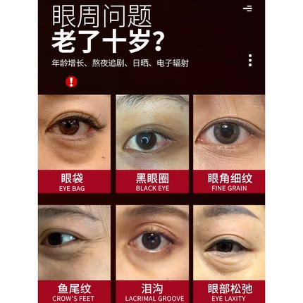 同仁堂蛇毒眼膜贴黑眼圈眼袋淡化细纹眼纹抗皱紧致抗衰老官方正品