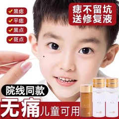 去痣点痣膏无痕正品点痣神器点痣水雀斑专用膏脸部韦医生除痣灵