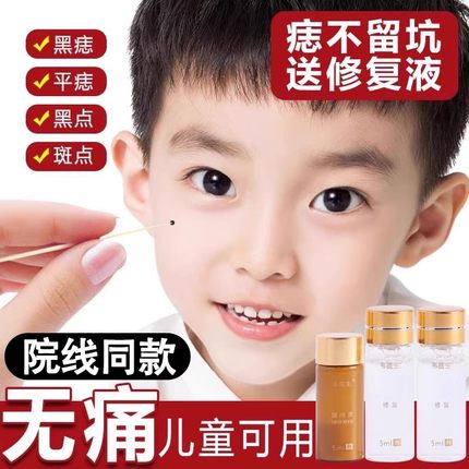去痣点痣膏无痕正品点痣神器点痣水雀斑专用膏脸部韦医生除痣灵