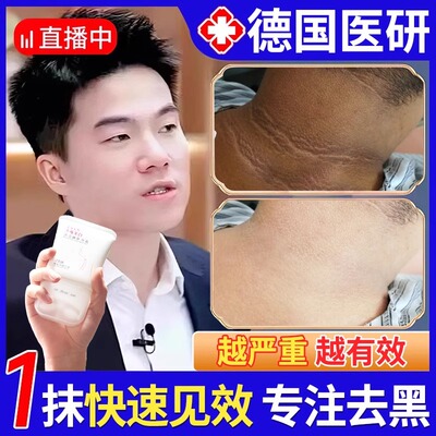 脖子黑色素去除黑棘皮症脖子黑色素沉淀洗不干净肥胖儿童美白神器