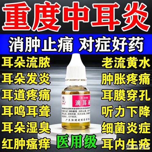 中耳炎专用特疼效药可除耳根滴耳液耳朵肿痛耳朵痒流脓流水耳油DT