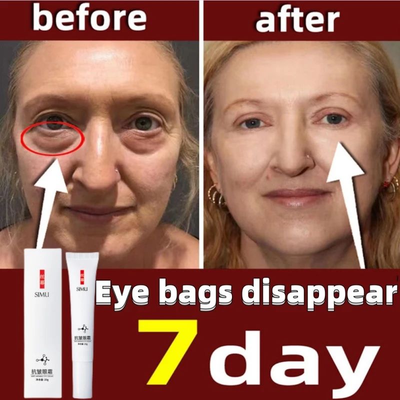 Remo??o instantanea do enrugamento O creme de olho, antienve