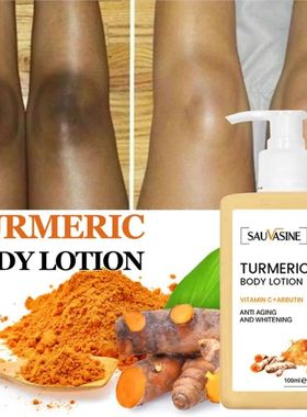 100ml creme de clareamento cúrcuma lo??o corporal pós-sol
